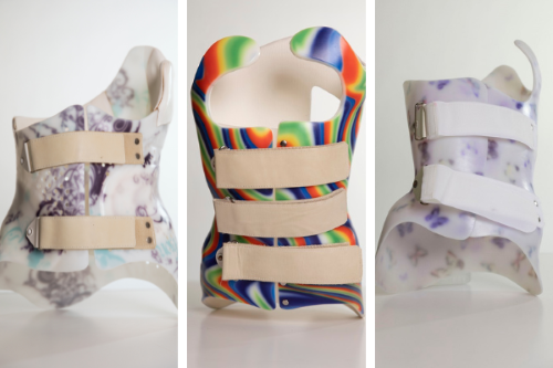 Three images of spinal braces decorated with colourful patterns are displayed in front of white backgrounds. 