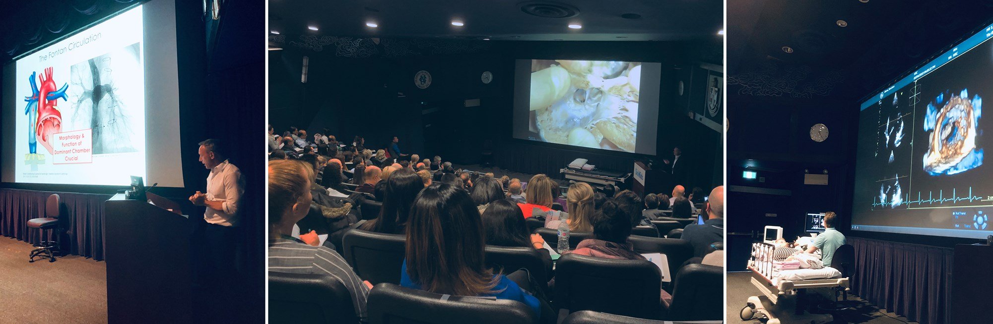 The Echocardiography Course on Congenital Heart Disease held at SickKids features echo-morphology correlation lectures, live scanning demonstrations and an international faculty of experts.