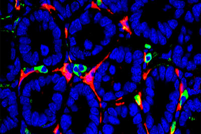 Macrophages and mesenchymal cells surrounded by a group of gut stem cells