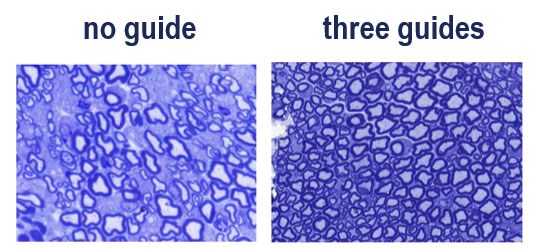 Scans of mouse sciatic nerves. On the left scan, the nerves appear scattered and did not receive treatment. On the right, the nerves appear more uniform after CRISPR-a treatment.