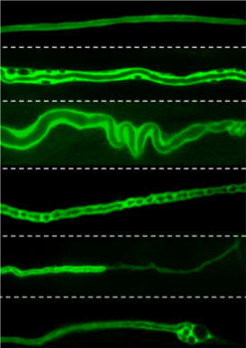 Scans of worms showing differences in excretory canals.