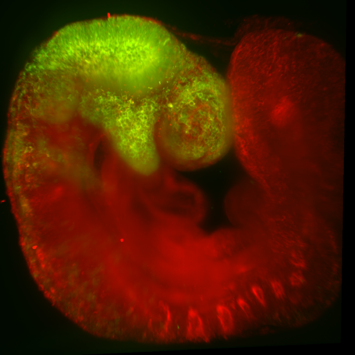 Image of neural crest anatomy
