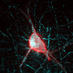 A parvalbumin interneuron (blue) surrounded by the perineuronal net.