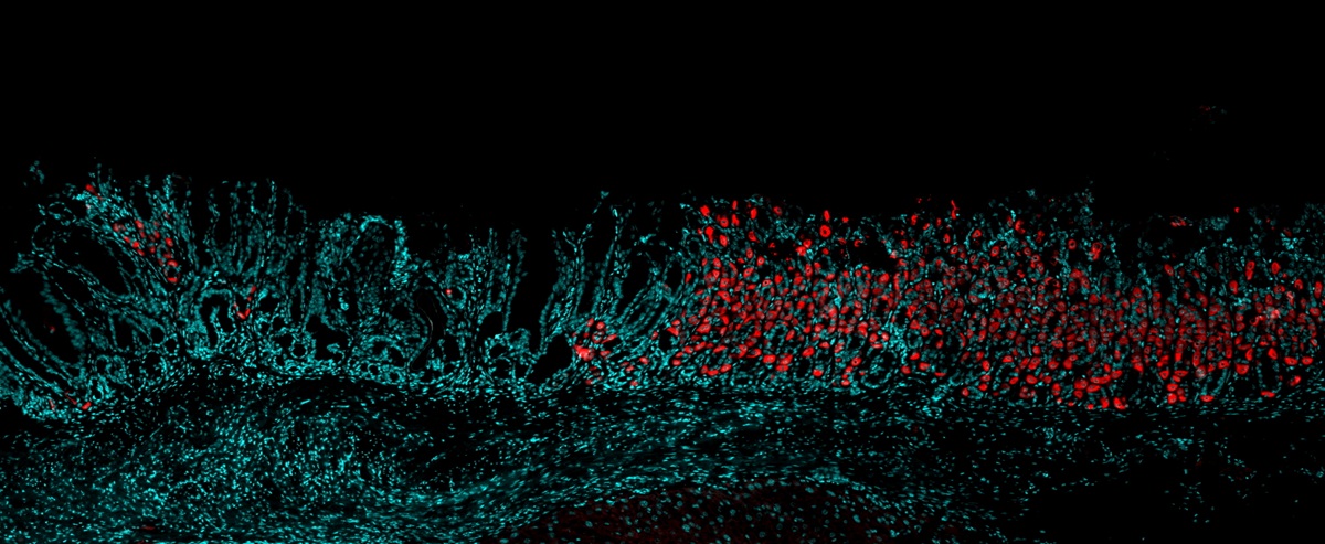 Cellular image of cells in the stomach lining