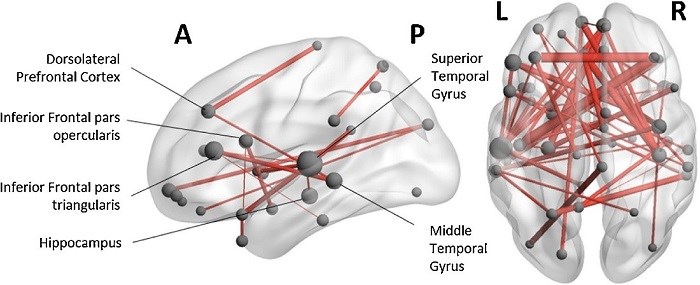 Brain diagram, described in caption.