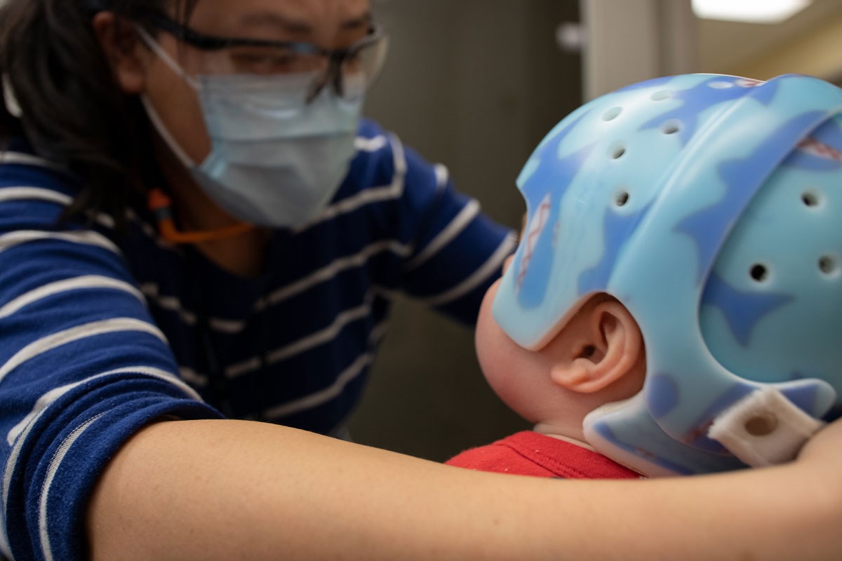 Orthotics Clinic staff securing a protective helmet on an infant's head