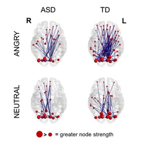 Four brain images showing the most activity in the angry left brain and the least in the neutral right brain.