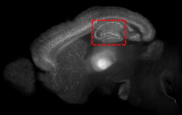 Black and white brain scan with a section outlined in a rectangle.