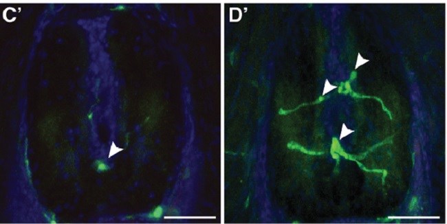 Zebrafish spinal cord.