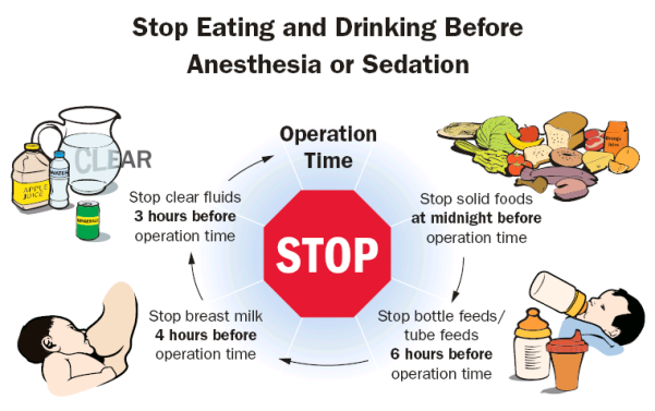 This diagram shows when patients need to stop eating and drinking solid foods, bottle/tube feeds, breast milk and clear fluids before surgery. 
