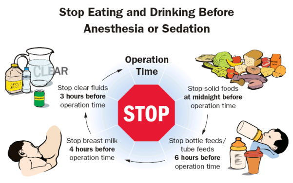 This diagram shows when patients need to stop eating and drinking solid foods, bottle/tube feeds, breast milk and clear fluids before surgery.