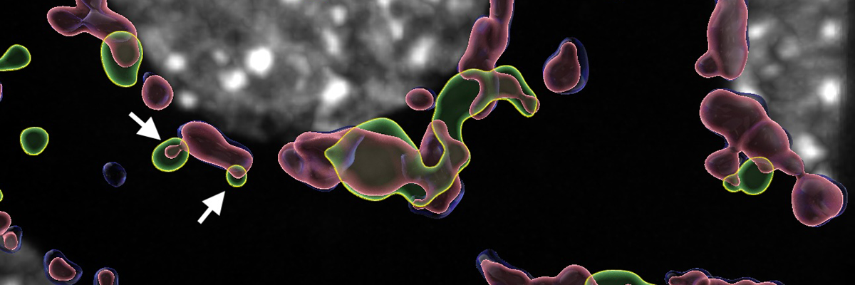 A grey circle surrounded by transparent blue, yellow and pink overlapping irregular shapes. An arrow points to places where all three coloured shapes overlap.