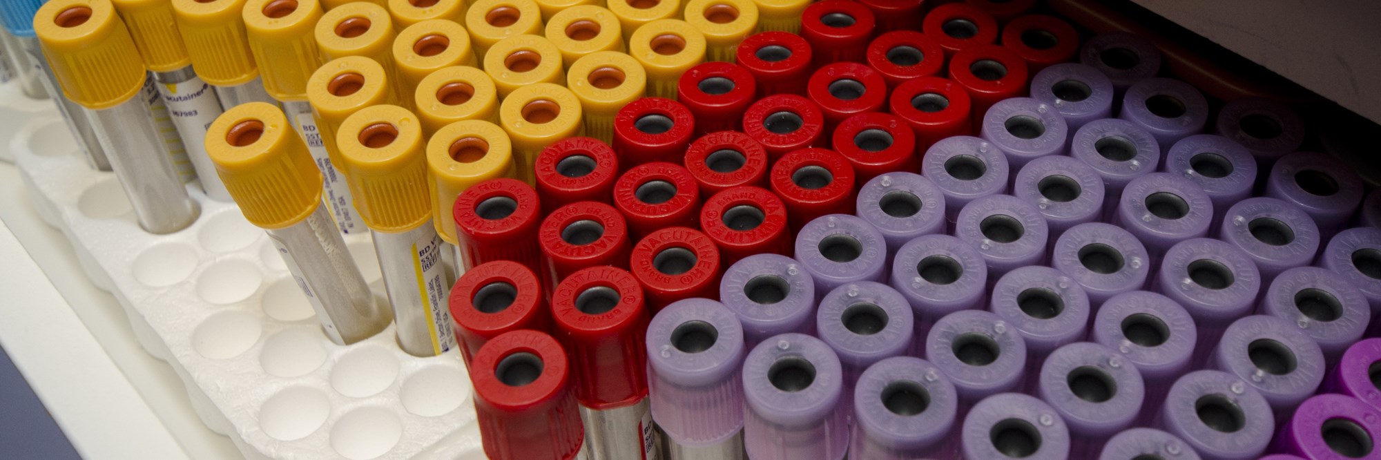 Dozens of blood samples with red, orange and purple lids