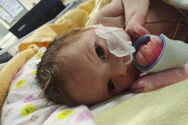 A small baby with a feeding tube lying in a hospital bed