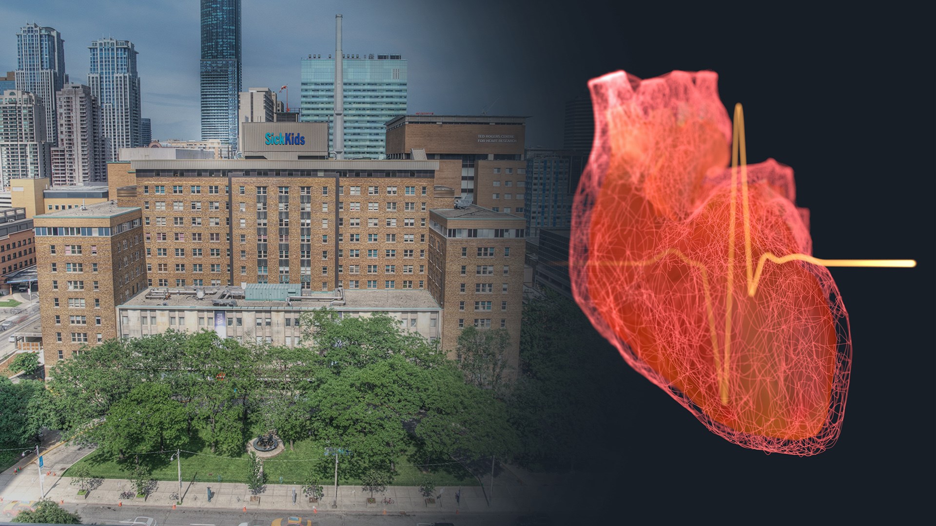 Collage showing SickKids hospital exterior on University Avenue next to a heartbeat illustration