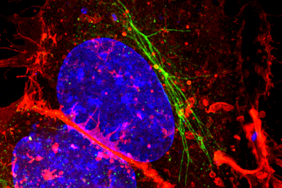 Samonella bacteria in a human cell