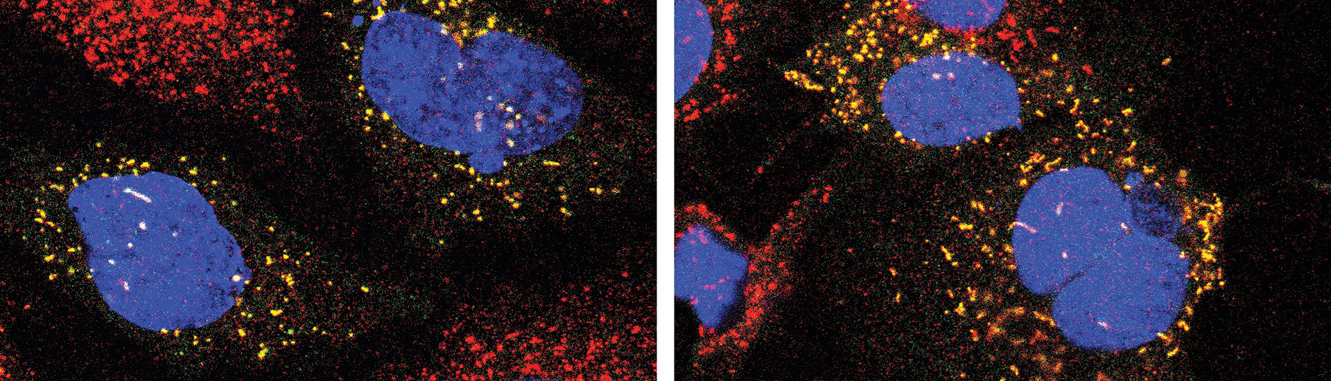 Blue oblong shapes against a black background with red and yellow dots surrounding the shapes showing disrupted and functioning cellular recycling.