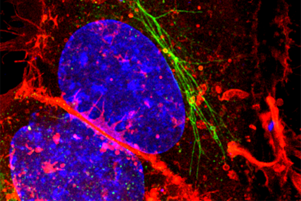 An image from the Brumell lab showing a human cell with long reservoirs of the plasma membrane (in green), which are utilized by bacteria upon infection. The remainder of the plasma membrane is in red and the cell's nucleus is blue.