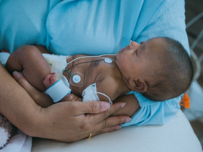 Person gently cradling baby with medical sensors and wires on chest and limbs.