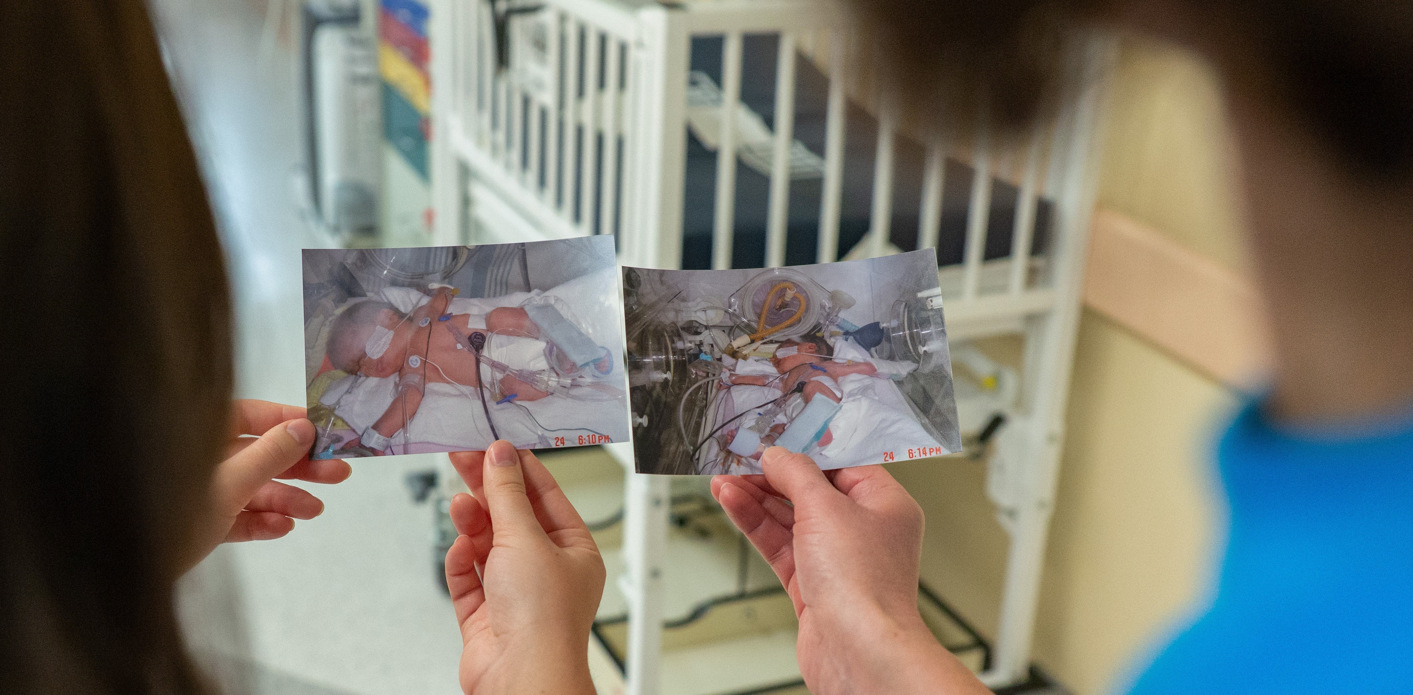 Two hands hold two photos of a premature baby in a  critical care setting with tubing attached.