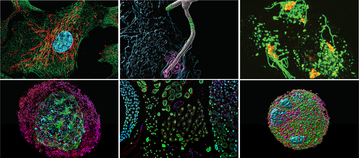 Collage of six images showing cells.
