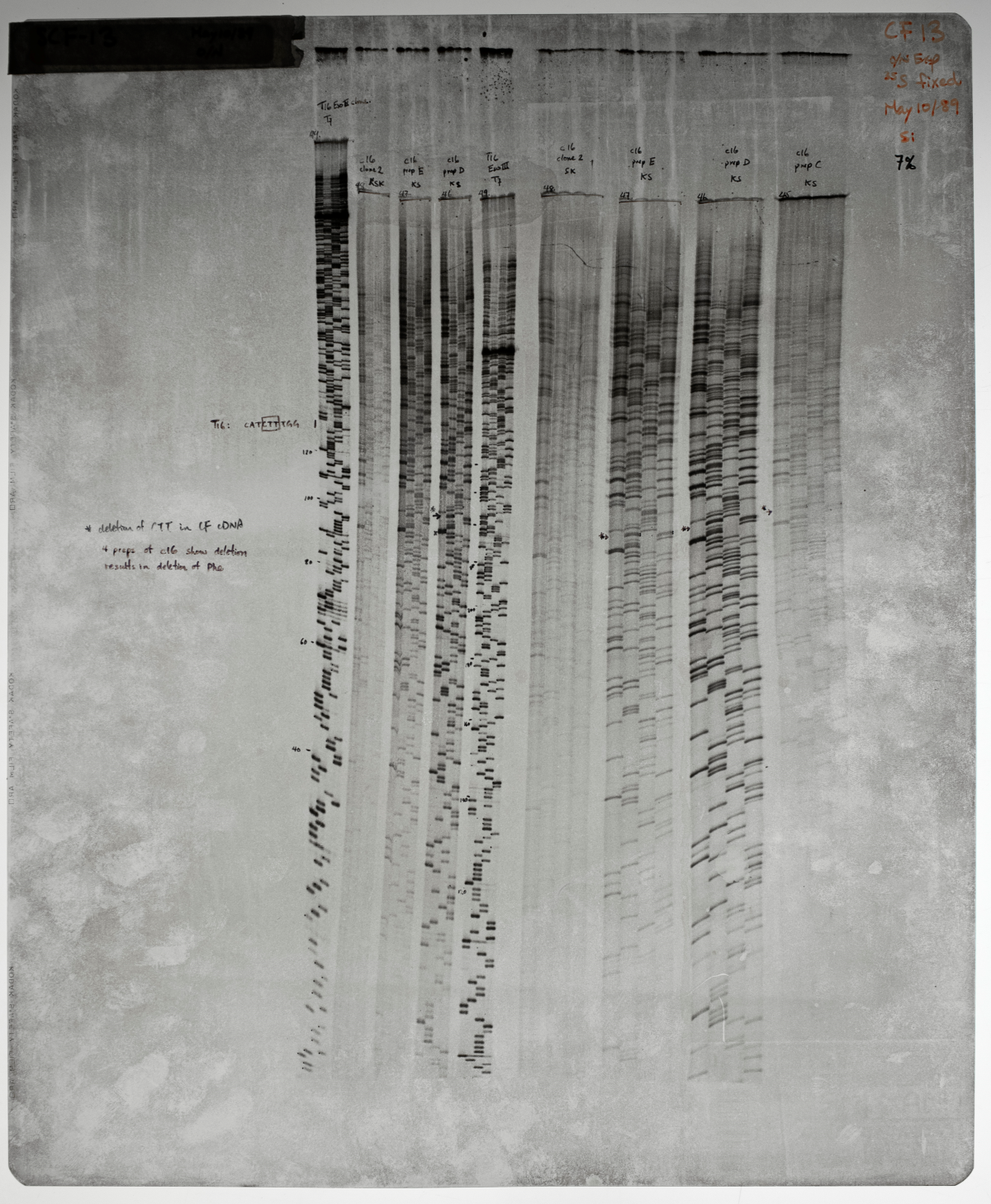 A gel electrophoresis of the cystic fibrosis gene. The scan shows several long rectangular strands with patterns of black, grey and white
